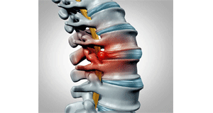 Infection of the Spine