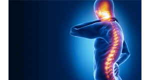 Spinal cord injuries