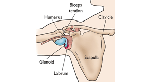 slap tear